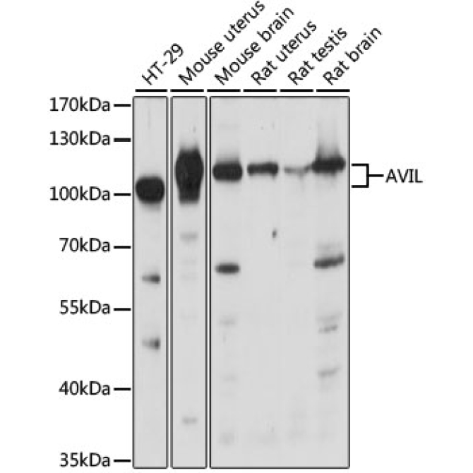 AVIL Rabbit Polyclonal Antibody