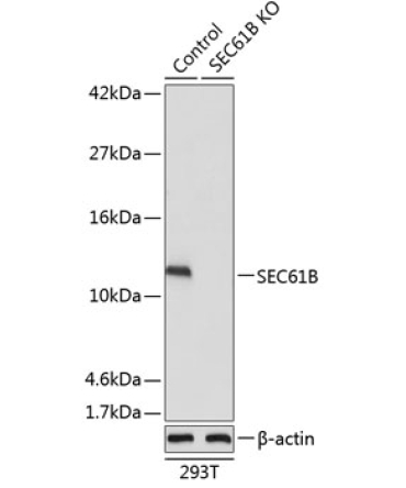 SEC61B Rabbit Polyclonal Antibody [KO Validated]