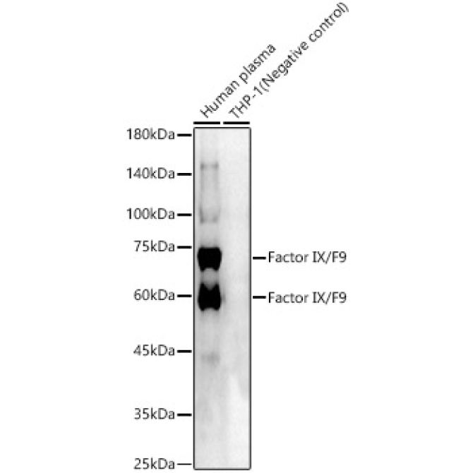 Factor IX / F9 Rabbit Polyclonal Antibody