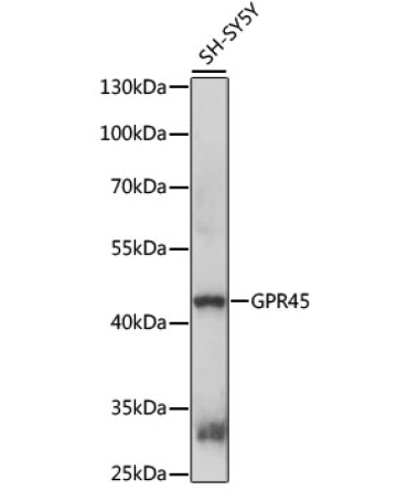 GPR45 Rabbit Polyclonal Antibody