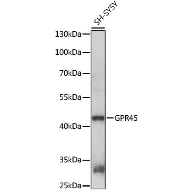 GPR45 Rabbit Polyclonal Antibody