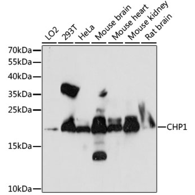 CHP1 Rabbit Polyclonal Antibody