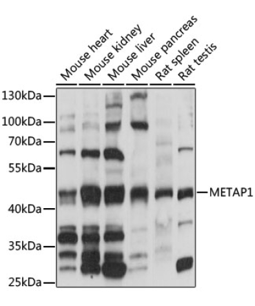 METAP1 Rabbit Polyclonal Antibody