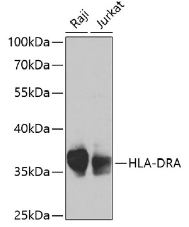 HLA-DRA Rabbit Polyclonal Antibody