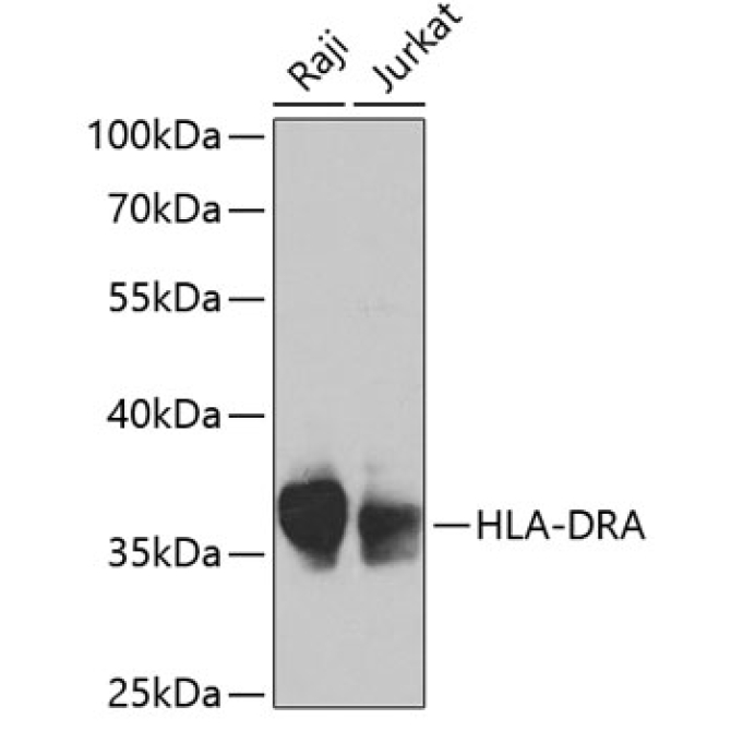 HLA-DRA Rabbit Polyclonal Antibody