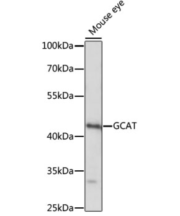 GCAT Rabbit Polyclonal Antibody