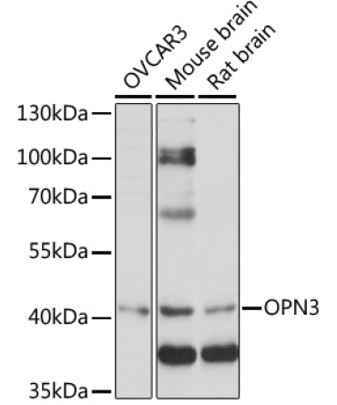OPN3 Rabbit Polyclonal Antibody