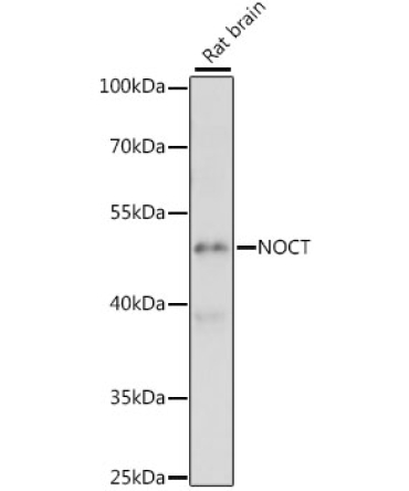 NOCT Rabbit Polyclonal Antibody