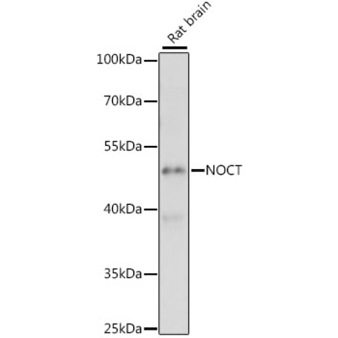 NOCT Rabbit Polyclonal Antibody