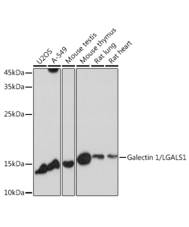 Galectin 1/LGALS1 Rabbit Polyclonal Antibody