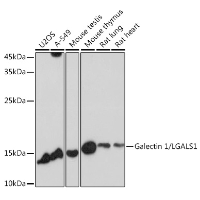 Galectin 1/LGALS1 Rabbit Polyclonal Antibody