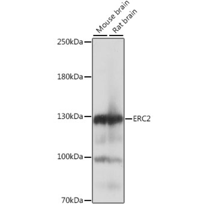 ERC2 Rabbit Polyclonal Antibody