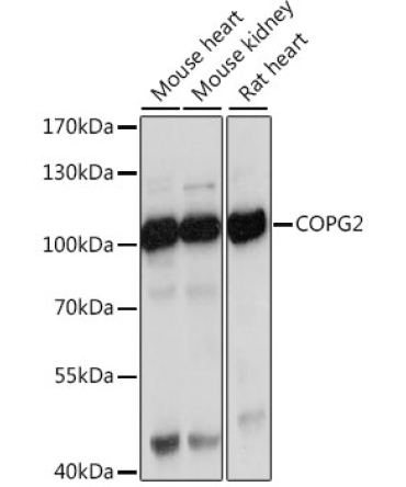 COPG2 Rabbit Polyclonal Antibody