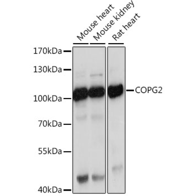COPG2 Rabbit Polyclonal Antibody