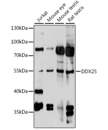 DDX25 Rabbit Polyclonal Antibody