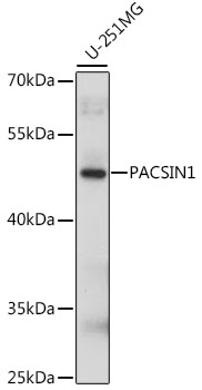 PACSIN1 Rabbit Polyclonal Antibody