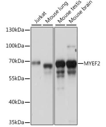 MYEF2 Rabbit Polyclonal Antibody