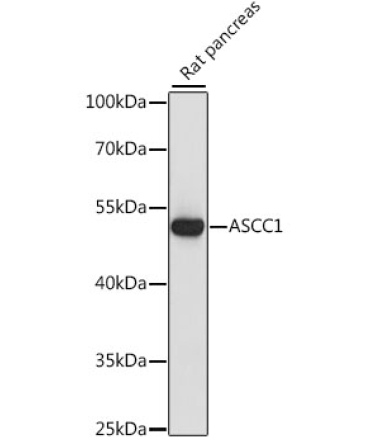 ASCC1 Rabbit Polyclonal Antibody