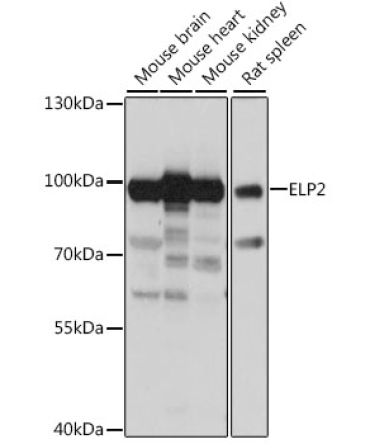 ELP2 Rabbit Polyclonal Antibody