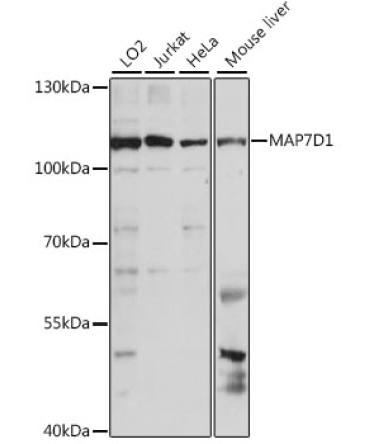 MAP7D1 Rabbit Polyclonal Antibody