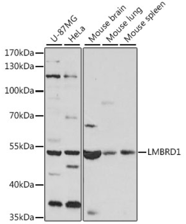 LMBRD1 Rabbit Polyclonal Antibody