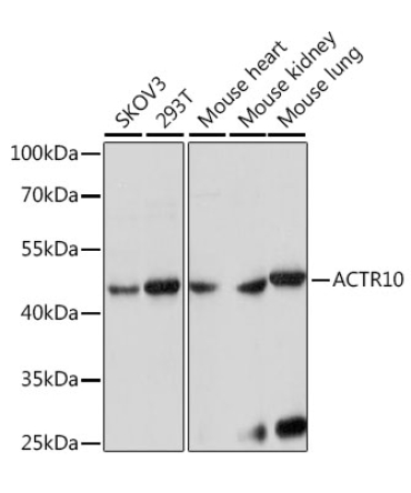 ACTR10 Rabbit Polyclonal Antibody