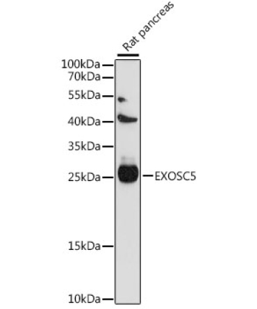 EXOSC5 Rabbit Polyclonal Antibody