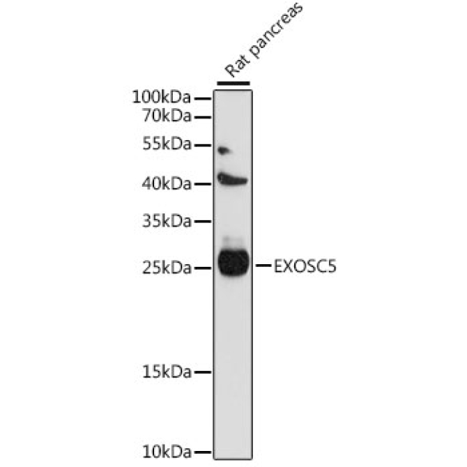 EXOSC5 Rabbit Polyclonal Antibody