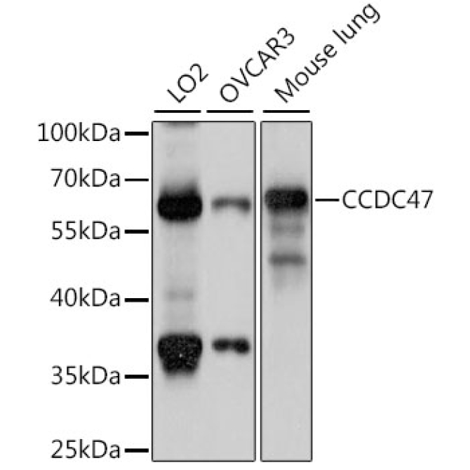 CCDC47 Rabbit Polyclonal Antibody