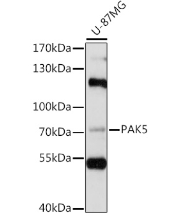 PAK5 Rabbit Polyclonal Antibody