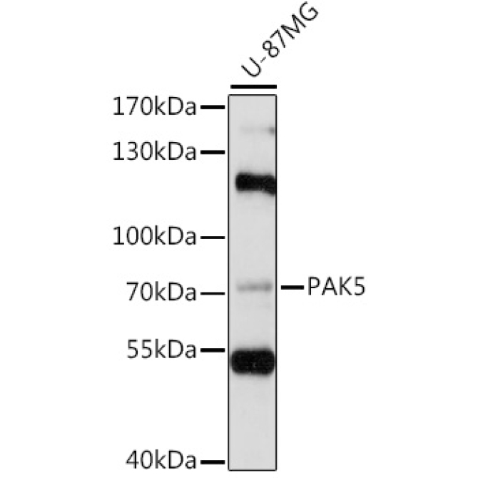 PAK5 Rabbit Polyclonal Antibody