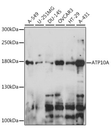 ATP10A Rabbit Polyclonal Antibody