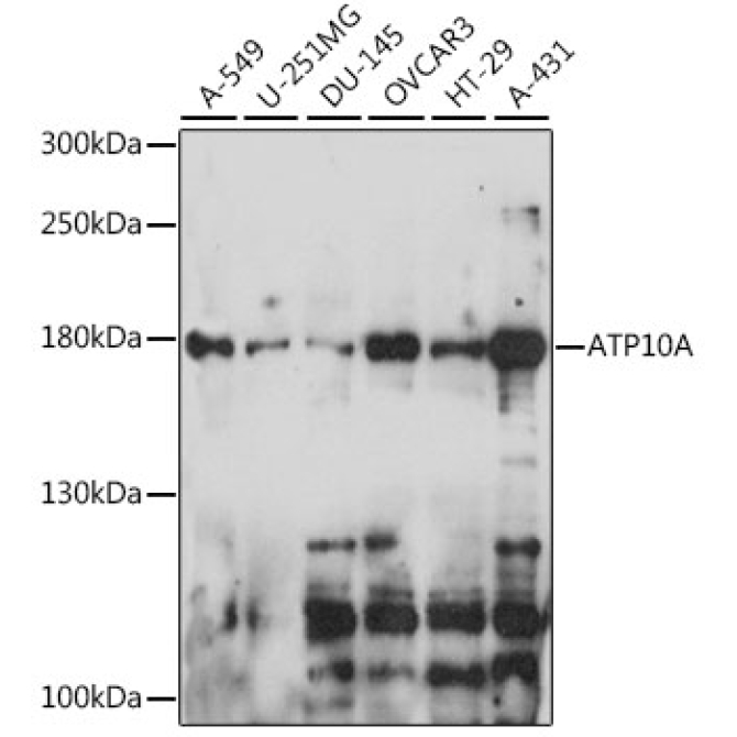 ATP10A Rabbit Polyclonal Antibody