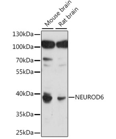 NEUROD6 Rabbit Polyclonal Antibody