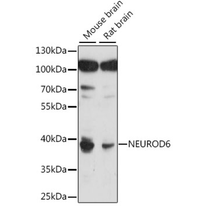 NEUROD6 Rabbit Polyclonal Antibody