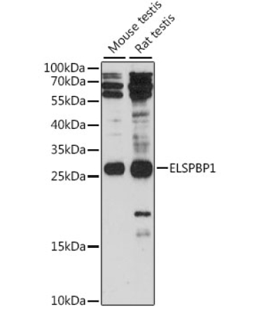 ELSPBP1 Rabbit Polyclonal Antibody