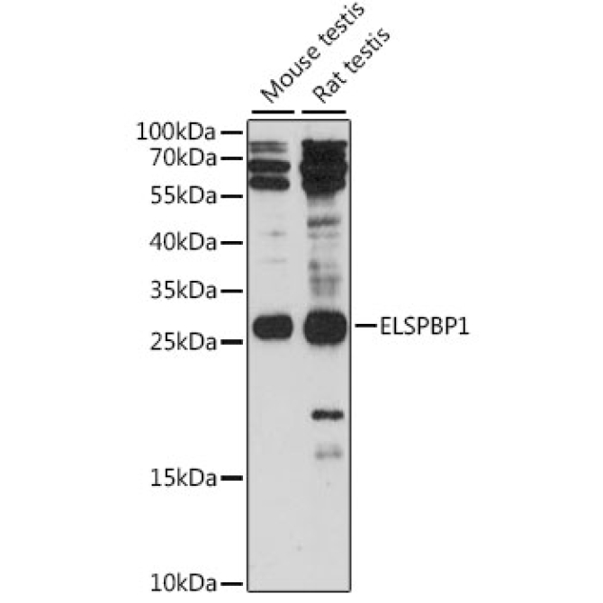 ELSPBP1 Rabbit Polyclonal Antibody