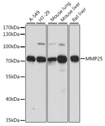 MMP25 Rabbit Polyclonal Antibody
