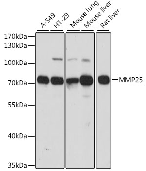 MMP25 Rabbit Polyclonal Antibody