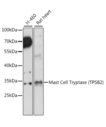 Mast Cell Tryptase (TPSB2) Rabbit Polyclonal Antibody