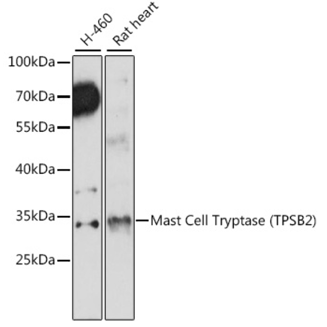 Mast Cell Tryptase (TPSB2) Rabbit Polyclonal Antibody