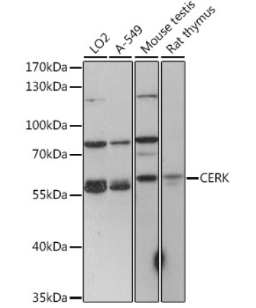 CERK Rabbit Polyclonal Antibody