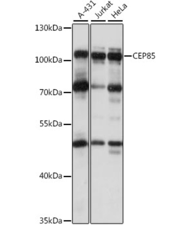 CEP85 Rabbit Polyclonal Antibody
