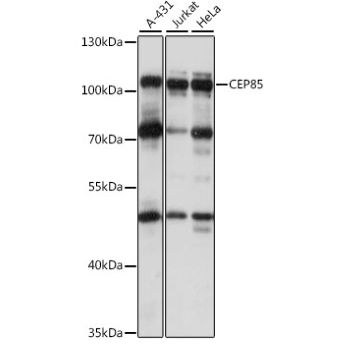 CEP85 Rabbit Polyclonal Antibody