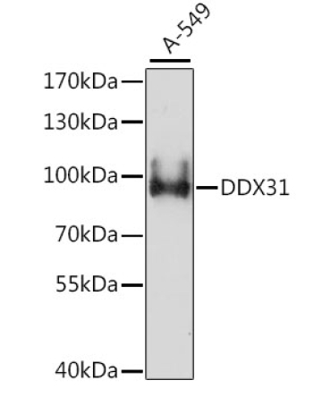 DDX31 Rabbit Polyclonal Antibody