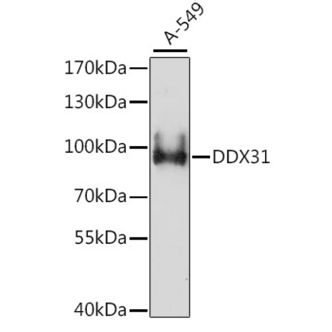 DDX31 Rabbit Polyclonal Antibody