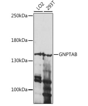 GNPTAB Rabbit Polyclonal Antibody