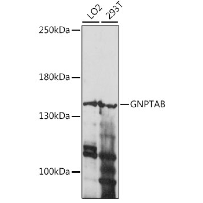 GNPTAB Rabbit Polyclonal Antibody