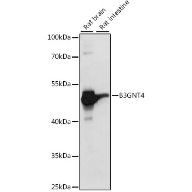 B3GNT4 Rabbit Polyclonal Antibody