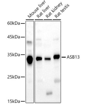 ASB13 Rabbit Polyclonal Antibody